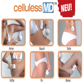 Cellu 5000 gegen Cellulite mit Vakuum