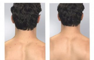 Derma Suction - porentief reiner Haut