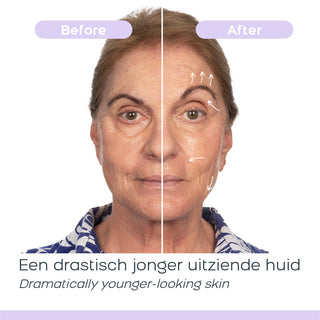 DermaWand PRO - Skin Care